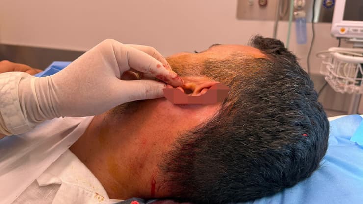 סתיו בן שושן הותקף בזמן חופשה באתונה