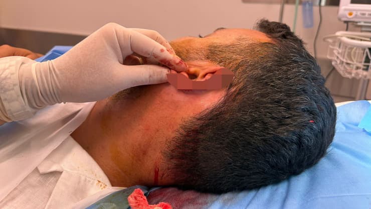 סתיו בן שושן הותקף בזמן חופשה באתונה