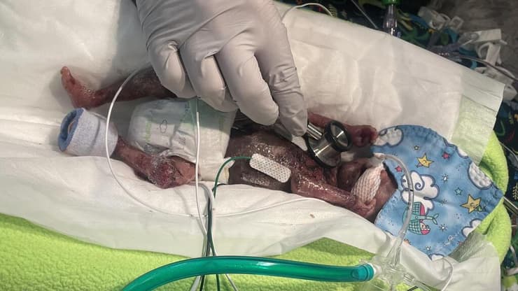 "אני אוהבת להתעורר אליו בכל בוקר". מולי קין על בנה נאש (צילום: מתוך עמוד הפייסבוק של University of Iowa Health Care Stead Family Children's Hospital) נאש קין