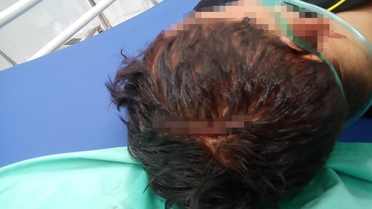 הנער שהותקף בטבריה