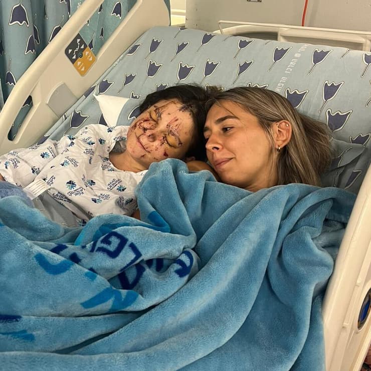 מוקפת בחברות, גם בעת האשפוז (צילום: אלבום פרטי) נועה אמבון שנפצעה קשה מטיל איראני בתל אביב, עם חברה בעת האשפוז באיכילוב