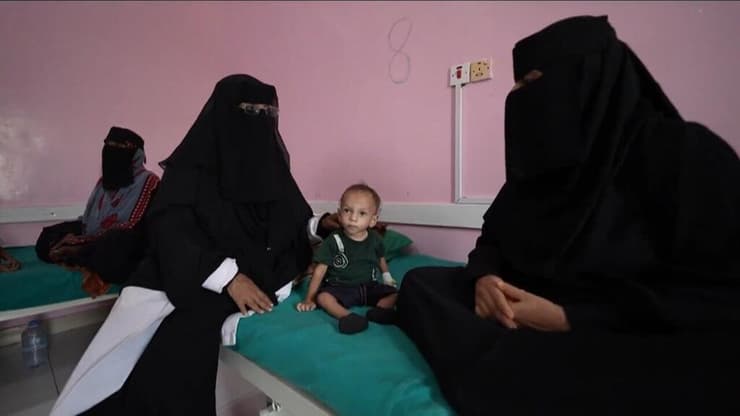 ילדים מקבלים טיפול רפואי ומזון בתימן