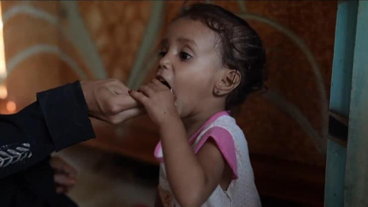 ילדים מקבלים טיפול רפואי ומזון בתימן