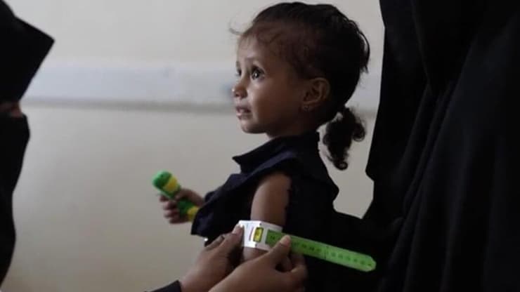 ילדה מקבלת טיפול רפואי בתימן