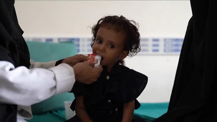 ילדים מקבלים טיפול רפואי ומזון בתימן