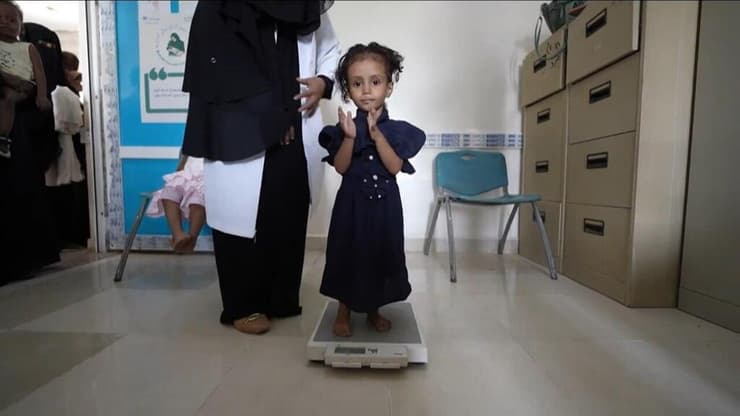 ילדים מקבלים טיפול רפואי ומזון בתימן