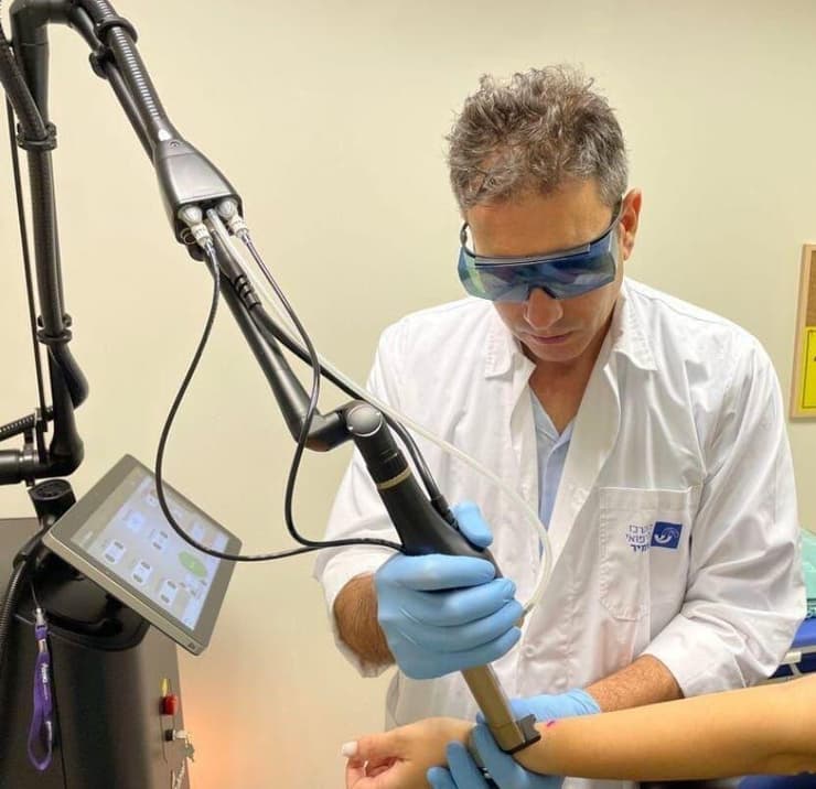 טיפול בצלקות באמצעות לייזר, אסף הרופא