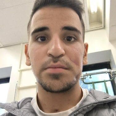 נתנאל ארנטרוי פציעה עזה צלקות