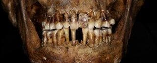 השיניים של האישה