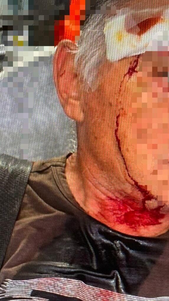 הקשיש שהותקף בכרמיאל