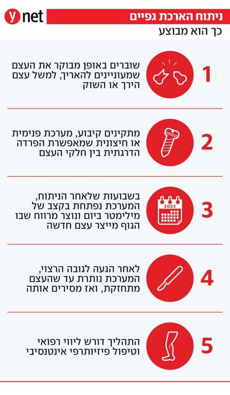 אינפו ניתוח הארכת גפיים אינפו ניתוח הארכת גפיים