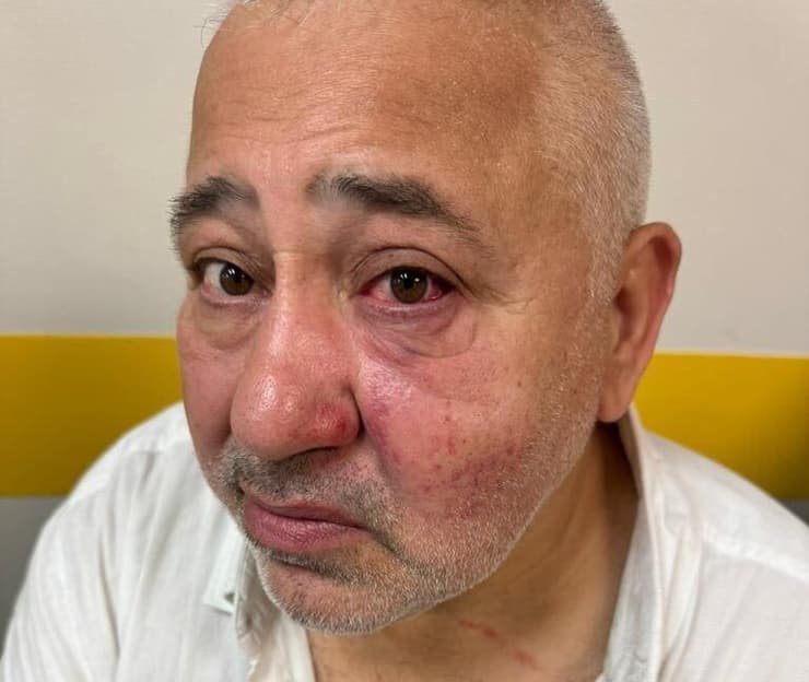 דובי סיטרוק, יהודי שהותקף בצרפת דובי סיטרוק, יהודי שהותקף בצרפת