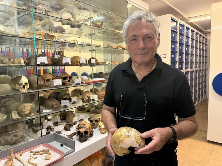 פרופ' הרשקוביץ עם הגולגולת