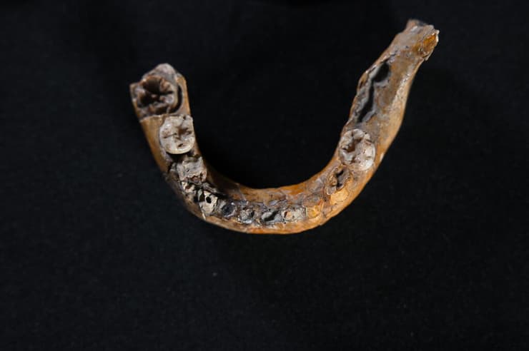 חלק מהגולגולת של הילד