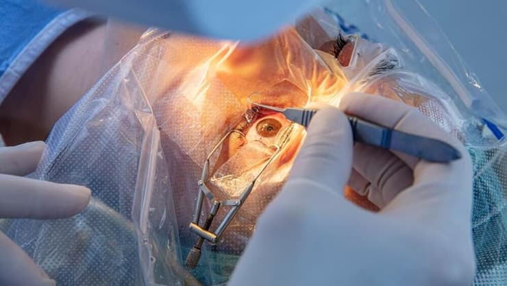 "הטיפול מחזיר לא רק את הראייה התקינה אלא גם את הביטחון והאיכות בחיים". ניתוח לתיקון פזילה (צילום: shutterstock) ניתוח פזילה