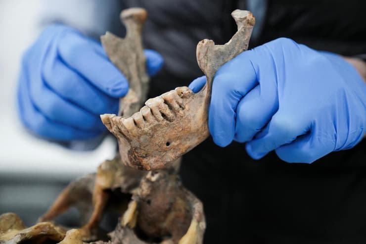 לסת תחתונה מגולגולת אדם, שנחפרה יחד עם גולגולות אחרות באתרים ארכאולוגיים סמוך לבוגוטה, בירת קולומביה