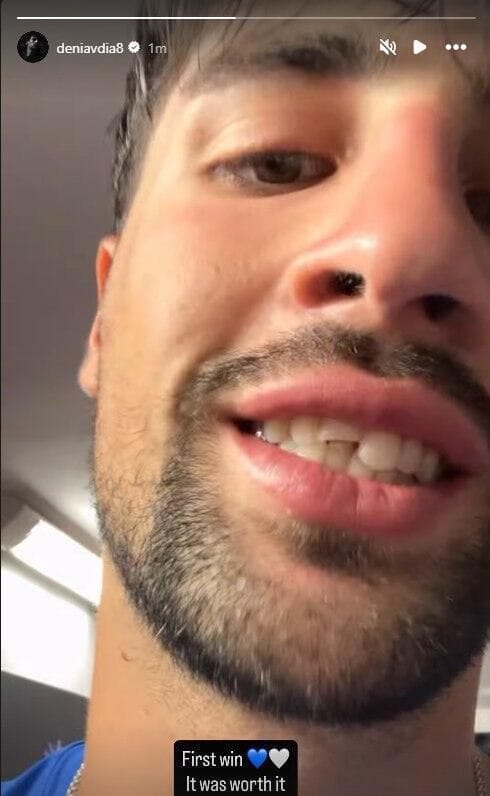 הסטורי של דני אבדיה עם השן השבורה