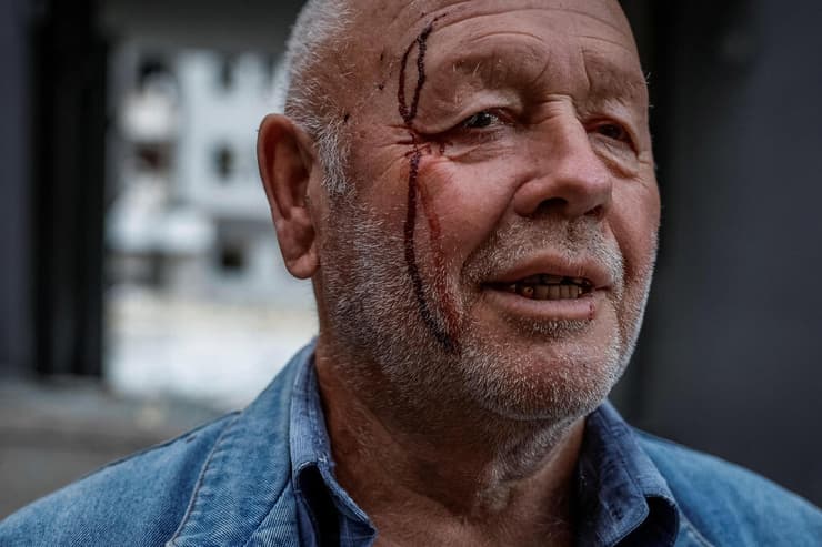 אוקראינה קייב מסוק כיבוי זירת פגיעה מתקפה רוסית