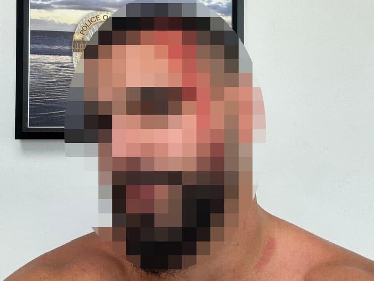 ישראלי שהותקף בלוס אנג'לס