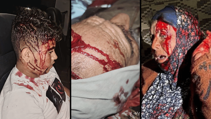 מתנחלים תקפו תושבים בכפר חלת אל-דבע, מסאפר יטא