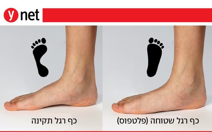 אינפו פלטפוס