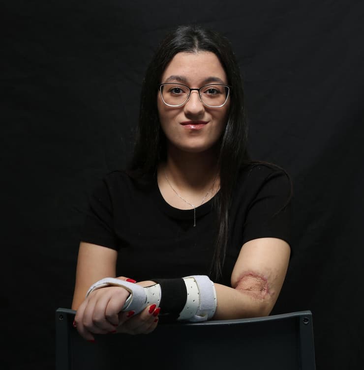 "לא הרגשתי את היד". יובל יחזקאל (צילום: ריאן פרויס) יובל יחזקאל