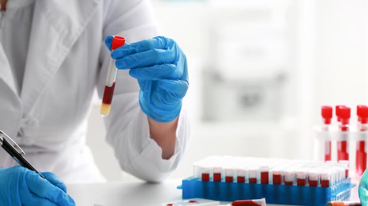 אילוסטרציה (צילום: shutterstock) בדיקת דם