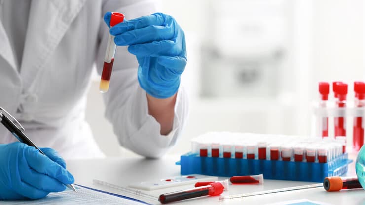 "בדיקת 'גלרי' גילתה את הסרטן ממש ברגע האחרון"
(צילום: shutterstock) בדיקת דם