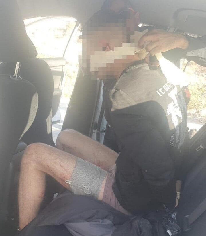 "גרר אותי בין הגלגלים עד שנתקל בבטונדה, ובלי היסוס החל לחזור רוורס". גנב הרכב שדרס את יצחייק 