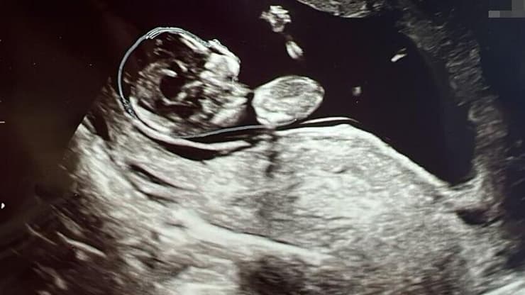 המסע של עדן ויאיר שטרן להורות באמצעות פונדקאית