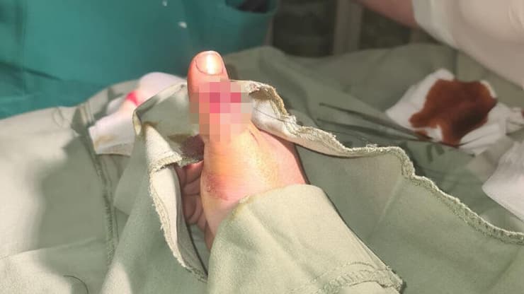 עובד ערבי בסופר בקריית אונו הותקף על רקע גזעני