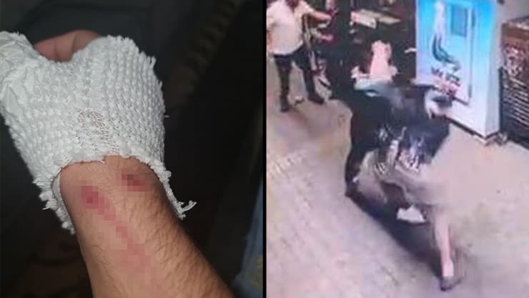 עובד ערבי בסופר בכפר יונה הותקף על רקע גזעני