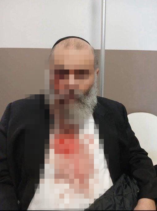 החרדי לאחר שהותקף