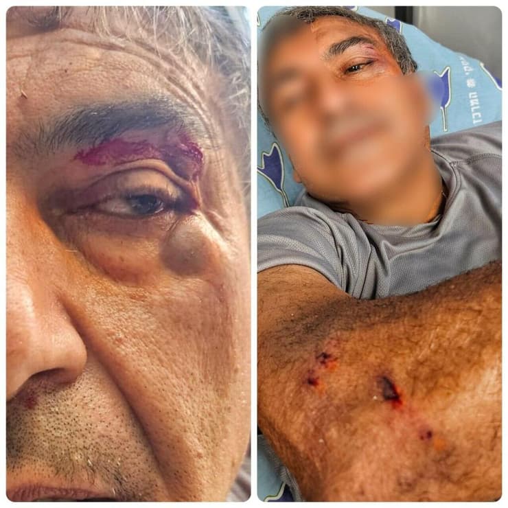 רפאל אליאסי אביו של הצל שהותקף בביתו