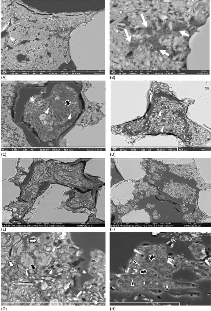 תמונות מתוך מיקרוסקופ אלקטרוני סורק של אוכלוסיית המיקרואורגניזמים החיה בתוך האבן