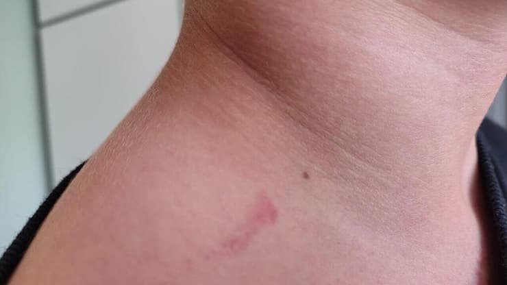 אנדי הילד המותקף