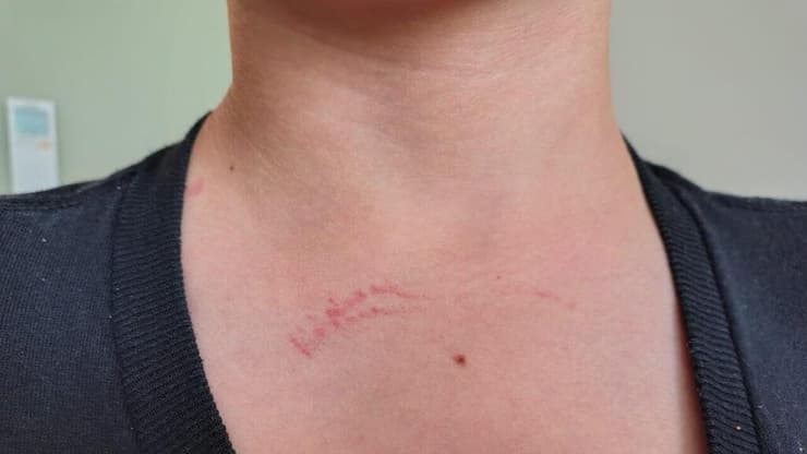 אנדי הילד המותקף