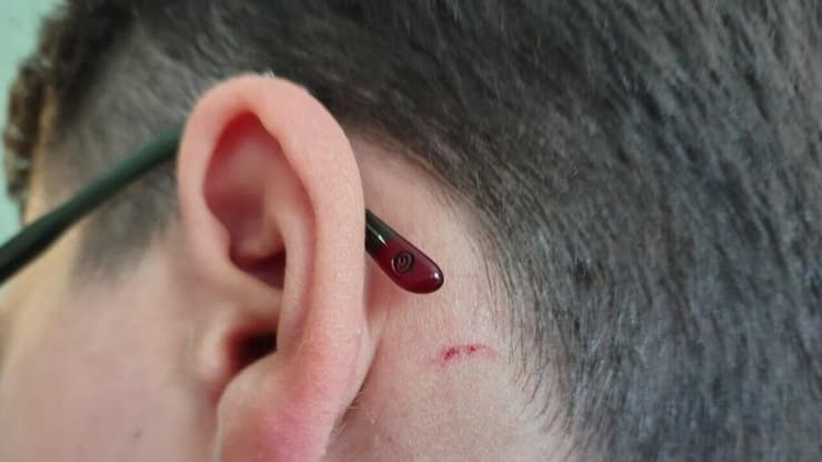 אנדי הילד המותקף