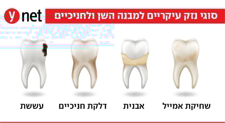 נזקי שיניים (צילום: Shutterstock) נזקי שיניים