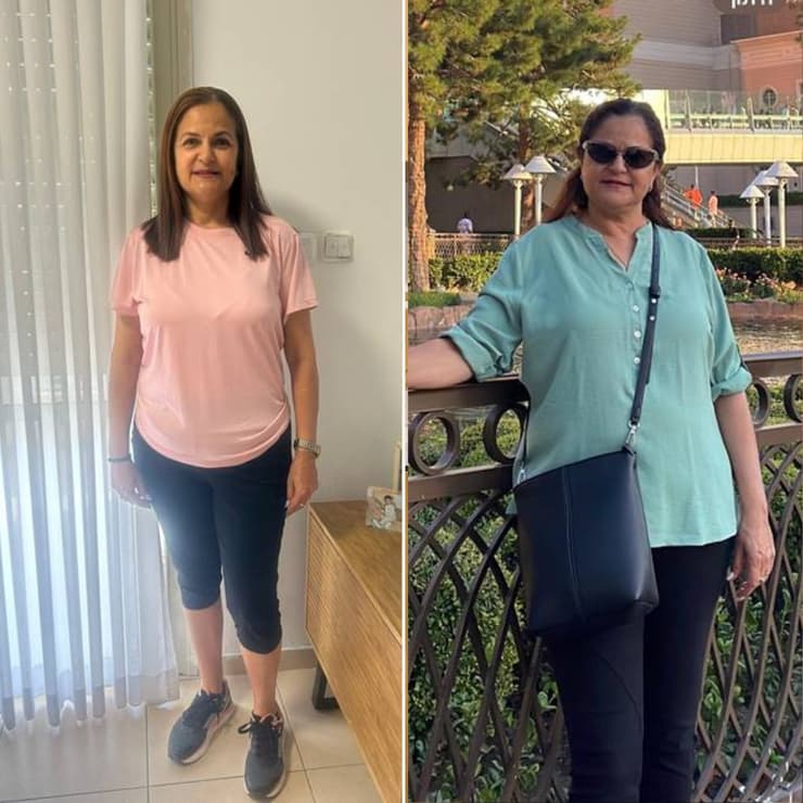 זיוה שרירא, לפני ואחרי (באדיבות אברהמסון ) זיוה שרירא, לפני ואחרי