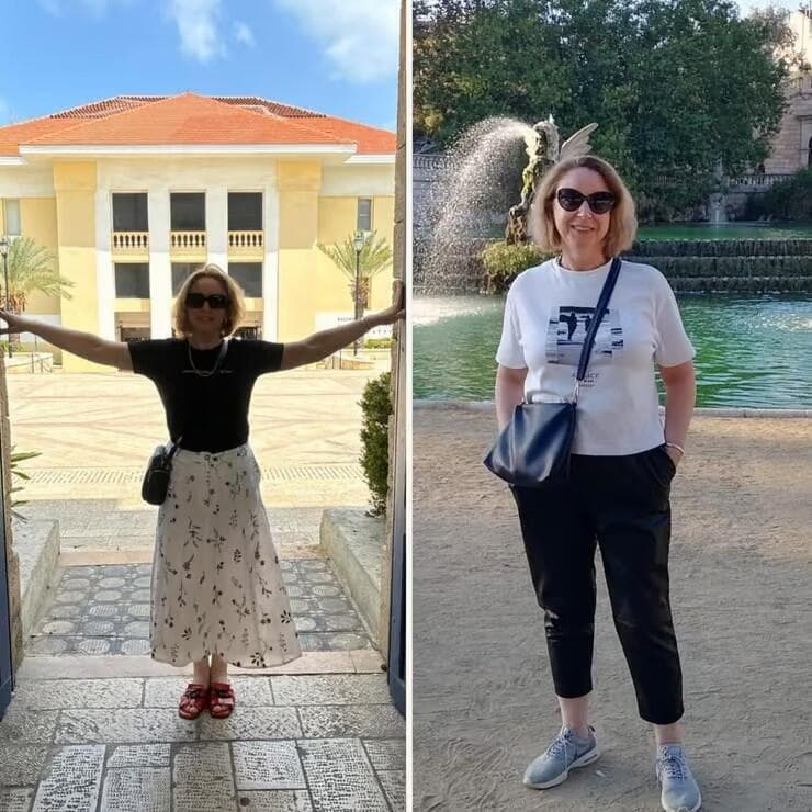 אינה קוברין, לפני ואחרי (באדיבות אברהמסון) אינה קוברין, לפני ואחרי