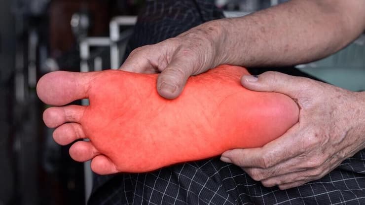 סוכרת, כף רגל סוכרתית