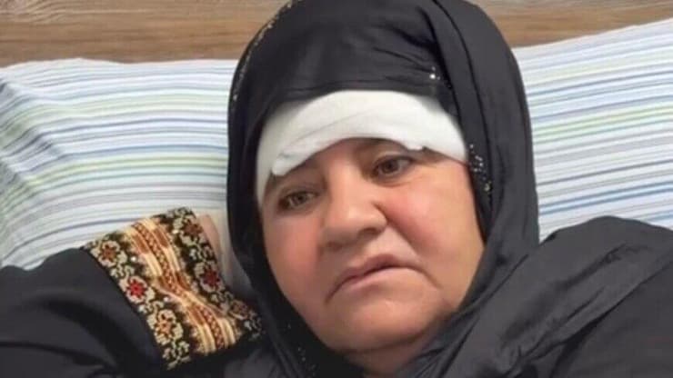 עפאף אבו עליא, בת 50, מותקפת על ידי מתנחלים בזמן מסיק זיתים