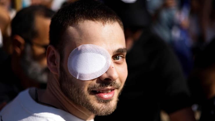 אלון עם חבישה בעינו, זכר לפציעה מ-7/10. שב לחייך (צילום: Jalaa MAREY / AFP) אלון אהל חוזר הביתה