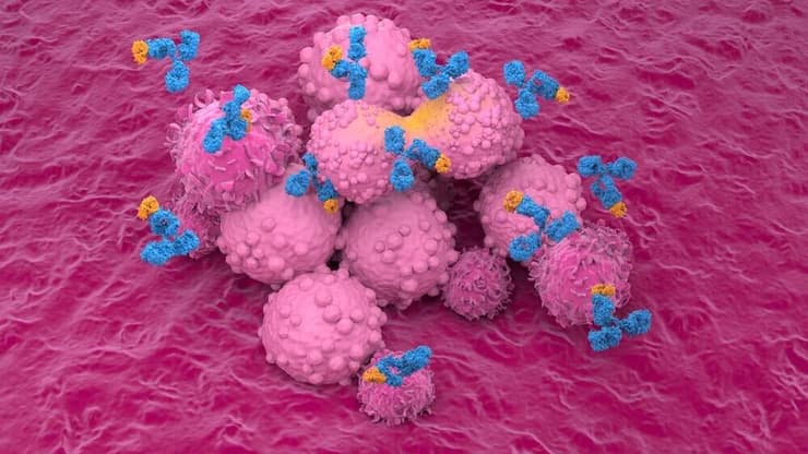 בבדיקה זו נצבעים התאים הסרטניים באופן שמזהה את הקולטנים. אילוסטרציה (צילום: shutterstock) טיפול נגד סרטן השד