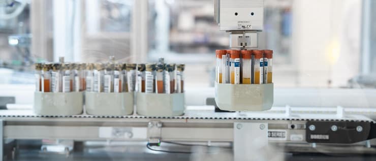 בדיקת גרייל לאבחון מוקדם - סרטן שד