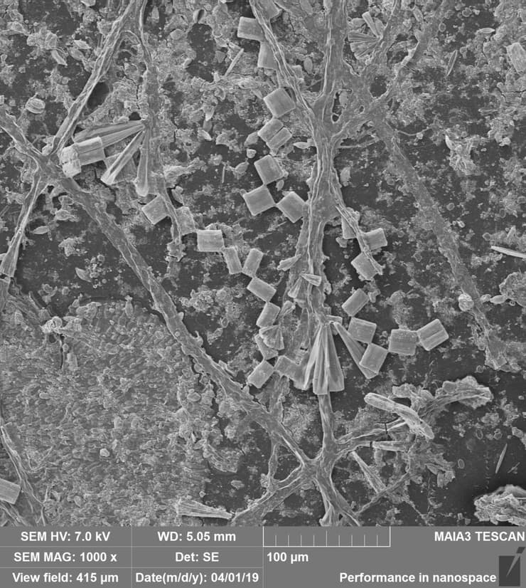תמונת מיקרוסקופ אלקטרונים של פני שטח פלסטיק מכוסה באצות צורניות ובמיקרואורגניזמים ימיים (צילום: יחידת המיקרוסקופיה, אוניברסיטת אריאל) תמונת מיקרוסקופ אלקטרונים של פני שטח פלסטיק מכוסה באצות צורניות ובמיקרואורגניזמים ימיים