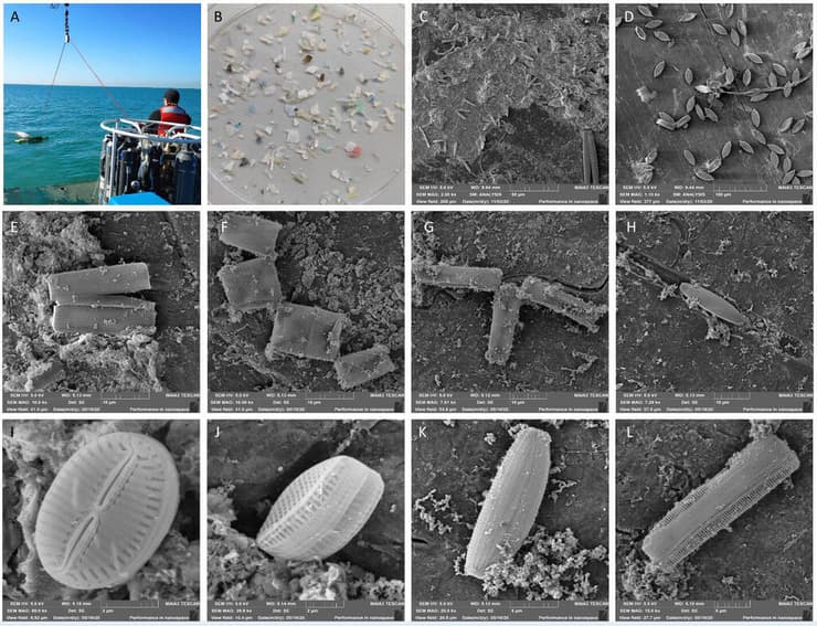 איסוף מיקרופלסטיק באמצעות רשת נגררת (A), דוגמה לחלקיקי מיקרופלסטיק (B) ותמונות מיקרוסקופ אלקטרונים של פני שטח פלסטיק מכוסה באצות צורניות ובמיקרואורגניזמים ימיים (C-L) (צילום: ד"ר מתן אורן, יחידת המיקרוסקופיה, אוניברסיטת אריאל) איסוף מיקרופלסטיק באמצעות רשת נגררת (A), דוגמה לחלקיקי מיקרופלסטיק (B) ותמונות מיקרוסקופ אלקטרונים של פני שטח פלסטיק מכוסה באצות צורניות ובמיקרואורגניזמים ימיים (C-L)