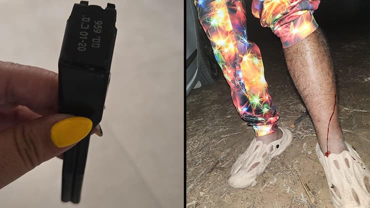 אחד המבלים שנפגעו במסיבה, ורסיס רימון הלם בחור שנפצע מרסיס רימון במסיבה בצפון