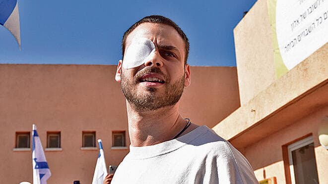 אלון אהל. "יעבור שיקום כל החיים, אבל הוא אופטימי ורוצה לצלול חזרה לחיים" (צילום: שרון צור) yk14565361